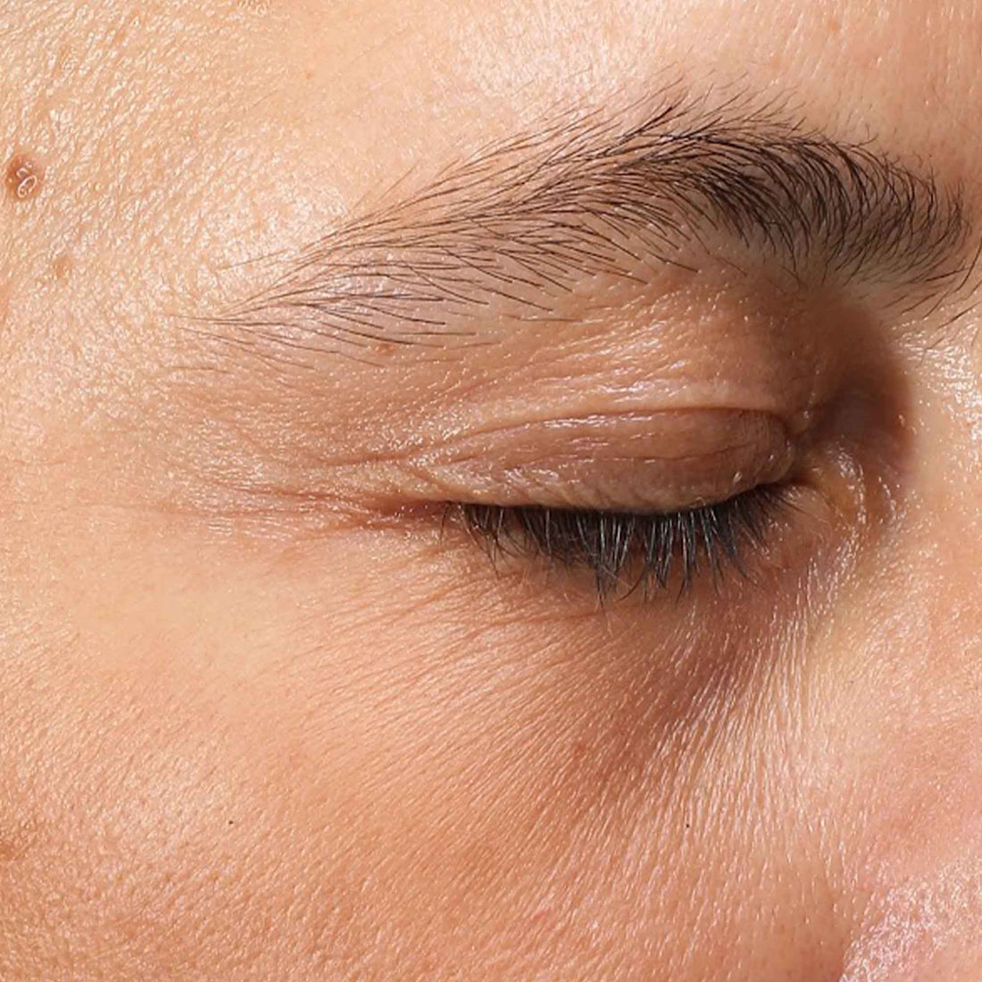 Crystal Retinal Ceramide Eye After 1 Use